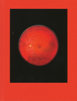 Retinal Shift Retinal Shift